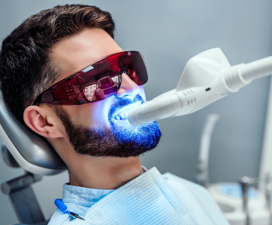 Teeth Whitening